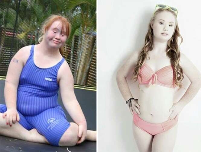 Jovem com síndrome de Down perde 40 quilos e inicia carreira de modelo