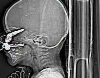 10 exames de raios-X incríveis que você não vai acreditar que são reais