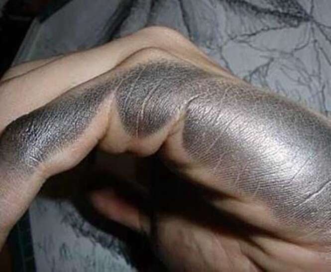 99