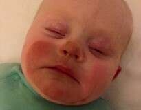 Mãe passa por bronzeamento artificial, amamenta bebê horas depois e criança fica com marca de bronzeado no rosto