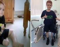 Menino de 11 anos pede amputação de sua perna após sofrer com condição de saúde e atitude causa comoção