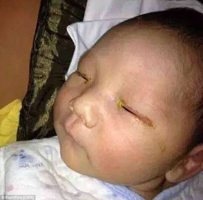 Bebê fica cego após amigo de sua família o fotografar sem desligar o flash
