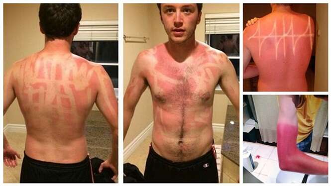 Divertidas - e horríveis - marcas de sol na pele