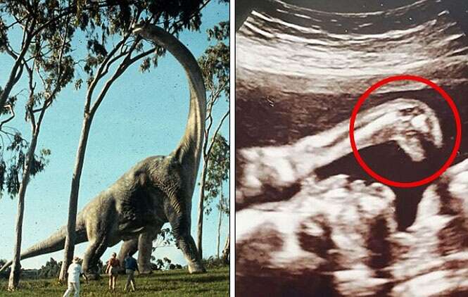 Futura mãe leva susto ao encontrar imagem de dinossauro em exame de ultrassom