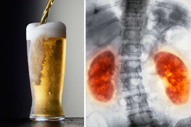Veja o que aconteceu com seu corpo quando você bebe cerveja