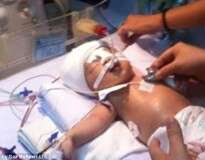 Recém-nascido fica em estado grave ao ser esfaqueado na cabeça, dentro de hospital, após ser atacado por mulher com quem dividia quarto