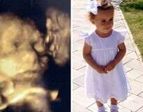 Grávida fica chocada ao ver imagem de avô beijando seu bebê em gestação durante exame de ultrassom