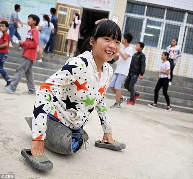 Menina perde as pernas ao salvar vida da mãe