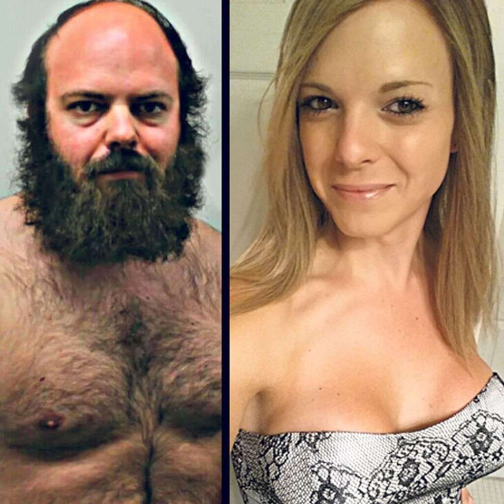 Homem peludo se transforma em mulher