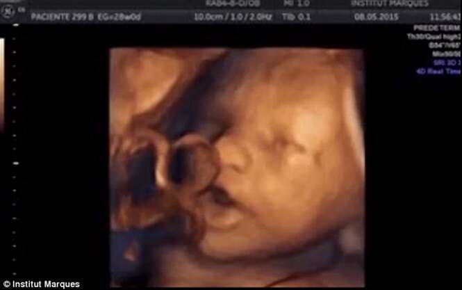 Ultrassons mostram bebês cantando dentro do útero de suas mães