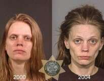 Imagens chocantes comparam o antes e o depois de pessoas que se tornaram viciadas em drogas