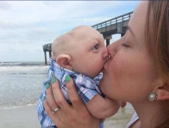 Bebê que nasceu sem parte do cérebro surpreende pais ao dizer suas primeiras palavras