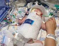 Bebê nasce sem respirar e médicos salvam sua vida lhe congelando embrulhando em plástico-bolha