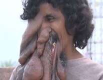 Conheça o “homem elefante” que possui tromba e é considerado Deus