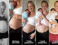 Blogueira inspira outras mulheres a aceitarem a transformação de seus corpos após a gravidez