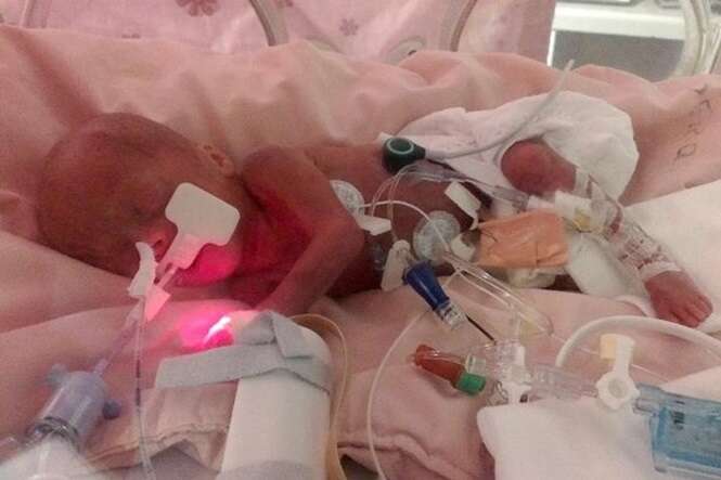 Criança tem recuperação incrível após pais negarem solicitação médica para desligarem aparelhos que a mantinham viva