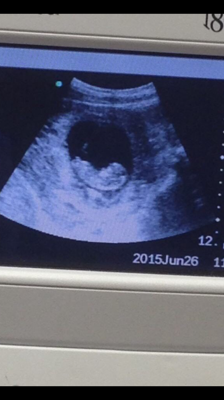 Imagem de espírito maligno surge em exame de ultrassom de grávida