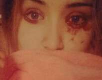 Menina sofre com condição misteriosa que a faz chorar sangue inesperadamente