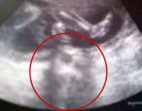 Grávida que havia abortado várias vezes dá à luz bebê saudável após imagem de Jesus aparecer em exame ultrassom