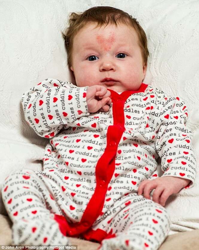 Bebê concebido no Dia dos Namorados nasce com marca de coração na testa