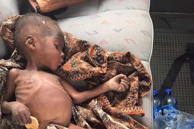 Menino de 2 anos passa 8 meses vagando pelas ruas à procura de comida após ser abandonado por pais