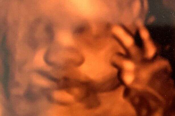 Bebê faz gesto grosseiro para mãe quando ela realizava exame de ultrassom