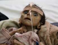 Imagem comovente mostra bebê de 5 meses lutando para viver apenas dois dias antes de morrer de fome no Iêmen