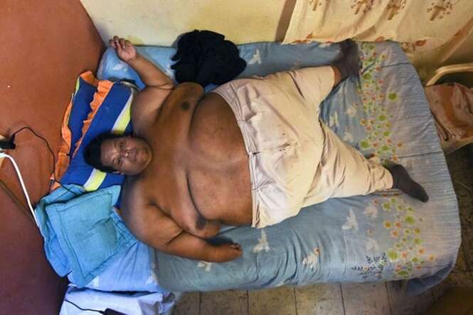 Homem mais gordo da Colômbia inicia tratamento para tentar salvar sua vida