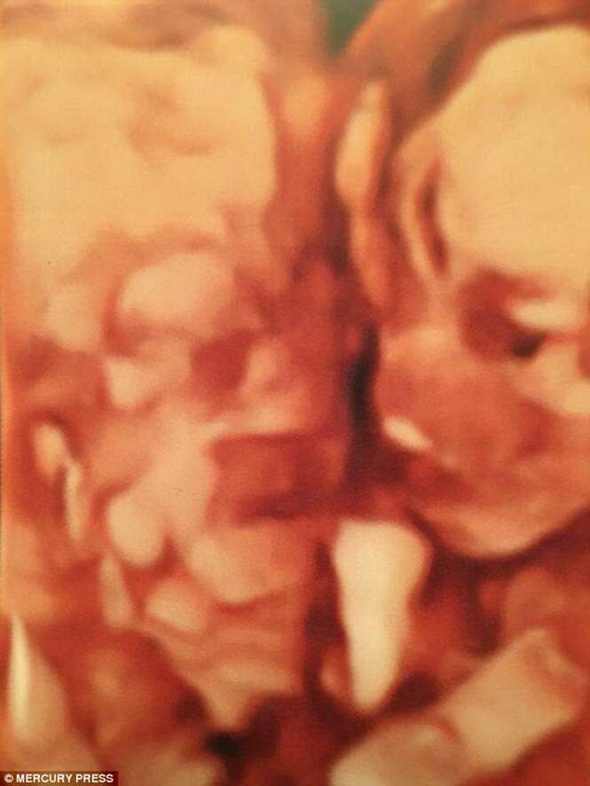 Gestante garante ter visto fantasma de sua falecida bisavó cuidando de seu bebê durante exame de ultrassom