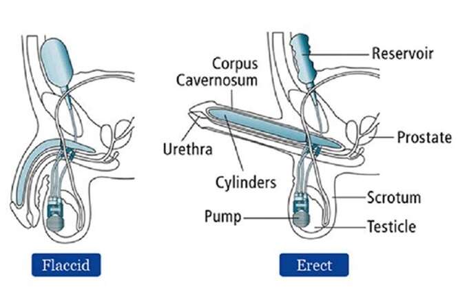 penisul egiptenilor cordyceps pentru erecție