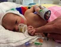 Bebê nasce com intestinos fora do corpo e escapa da morte graças à atitude surpreendente dos médicos