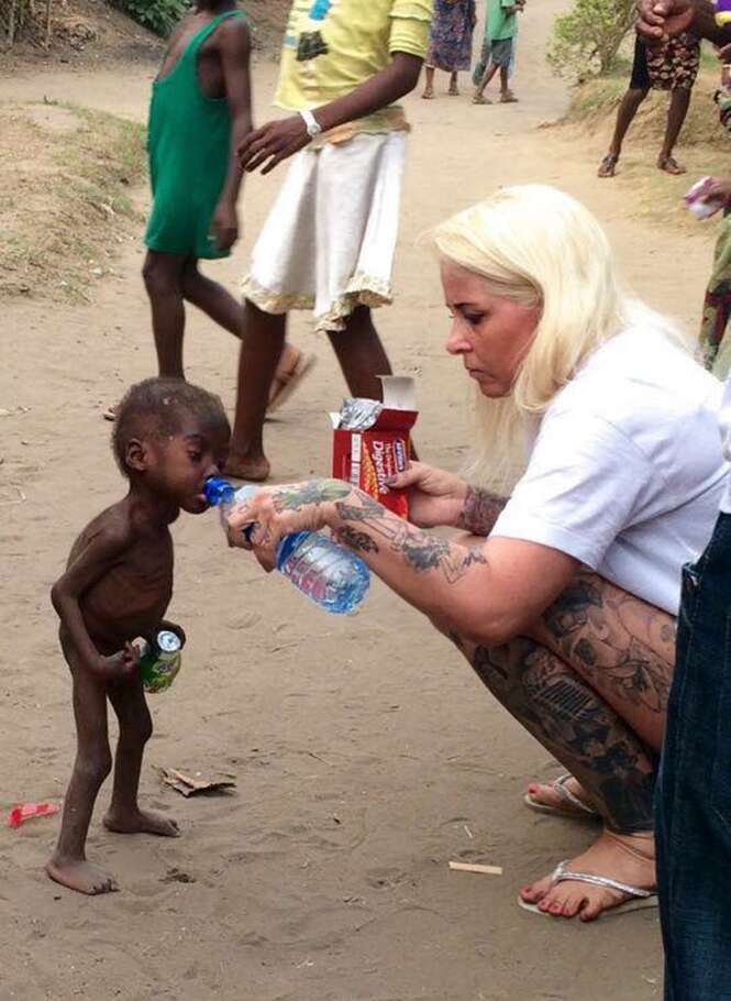 Menino nigeriano de 2 anos tem recuperação surpreendente após ser abandonado pelos pais