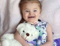 Médicos afirmam que menina com rara condição nunca poderia sorrir, mas agora ela não consegue tirar a felicidade do rosto