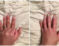 Marido permite esposa que não tem um dedo pintar sua unha e gesto comove internautas no Facebook