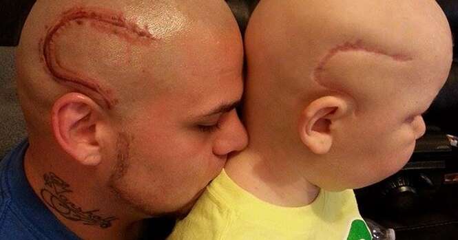 Pai faz tatuagem na cabeça para aumentar a autoconfiança do filho doente