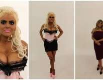 Mulher sofre drástica transformação ao fazer tratamento para se parecer com boneca Barbie