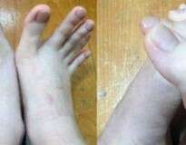 Mulher confunde internautas após postar fotos de seus dedos dos pés… ou será das mãos?