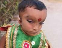 Criança com quadro médico desconhecido é adorada como deus na Índia