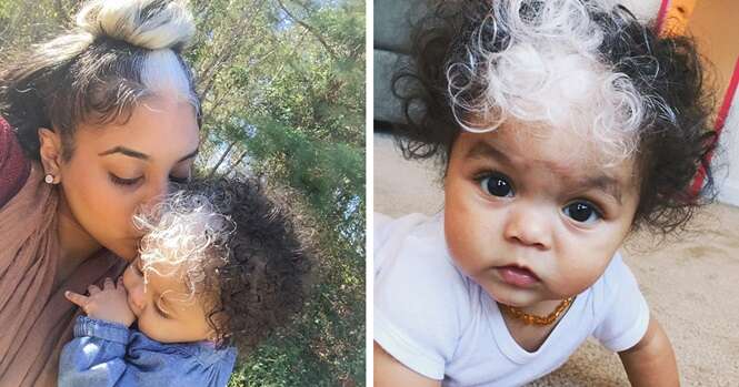 Esta menininha nasceu com uma mecha branca de cabelo idêntica a da mãe