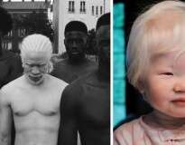 30 pessoas albinas que vão te hipnotizar com sua beleza de “outro mundo”