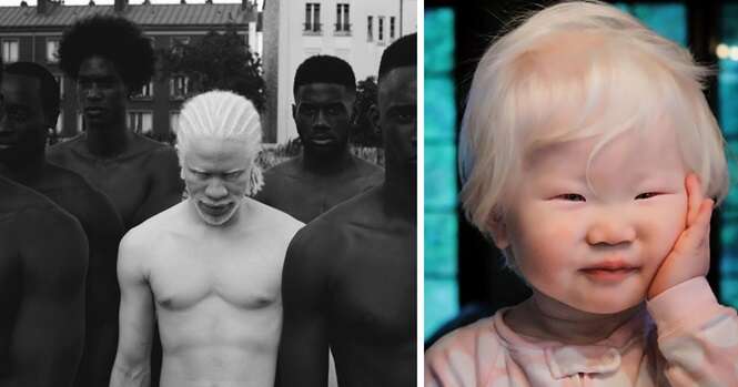 Pessoas albinas que vão te hipnotizar com sua beleza de “outro mundo”