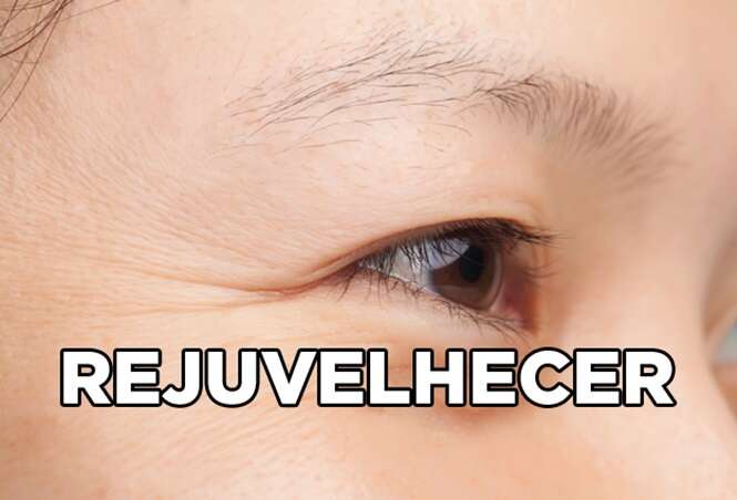 Foto: 