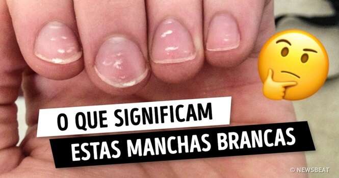 O que as unhas dizem sobre a nossa saúde