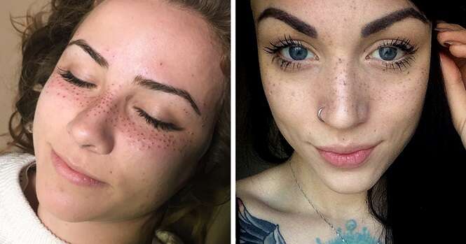 Tatuar sardas na face é nova mania de beleza