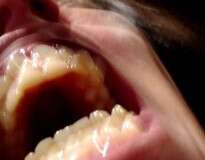 15 provas de que ir ao dentista no passado era algo que realmente dava medo