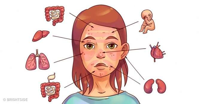 Problemas dentro de você revelados através de erupções na pele