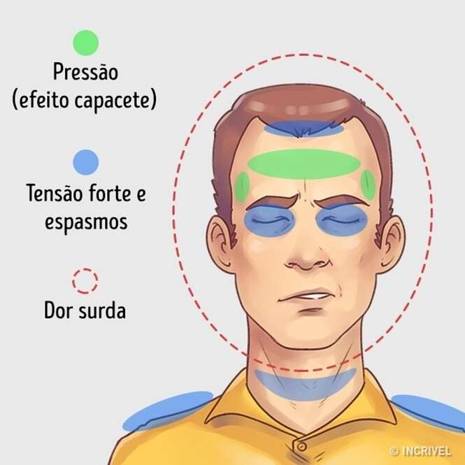 Como aliviar rapidamente 5 tipos de dores de cabeça