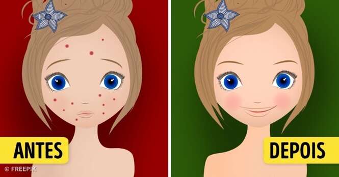 Duas maneiras sensacionais para eliminar manchas na pele