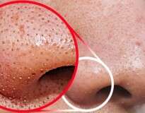 7 dicas de beleza impressionantes para você ficar ótima