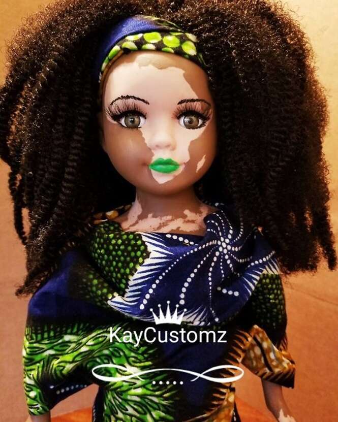 Artista cria bonecas com vitiligo para crianças que possuem essa rara condição de pele